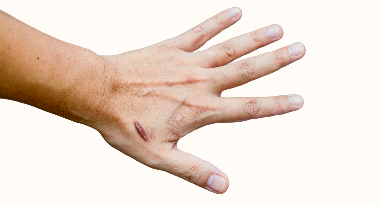 Smiling woman with braided hair against light background.