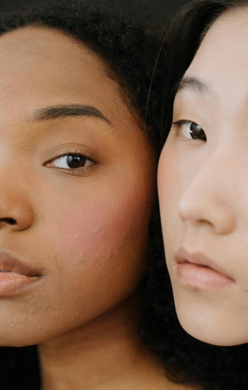 Medical Dermatology in Nairobi